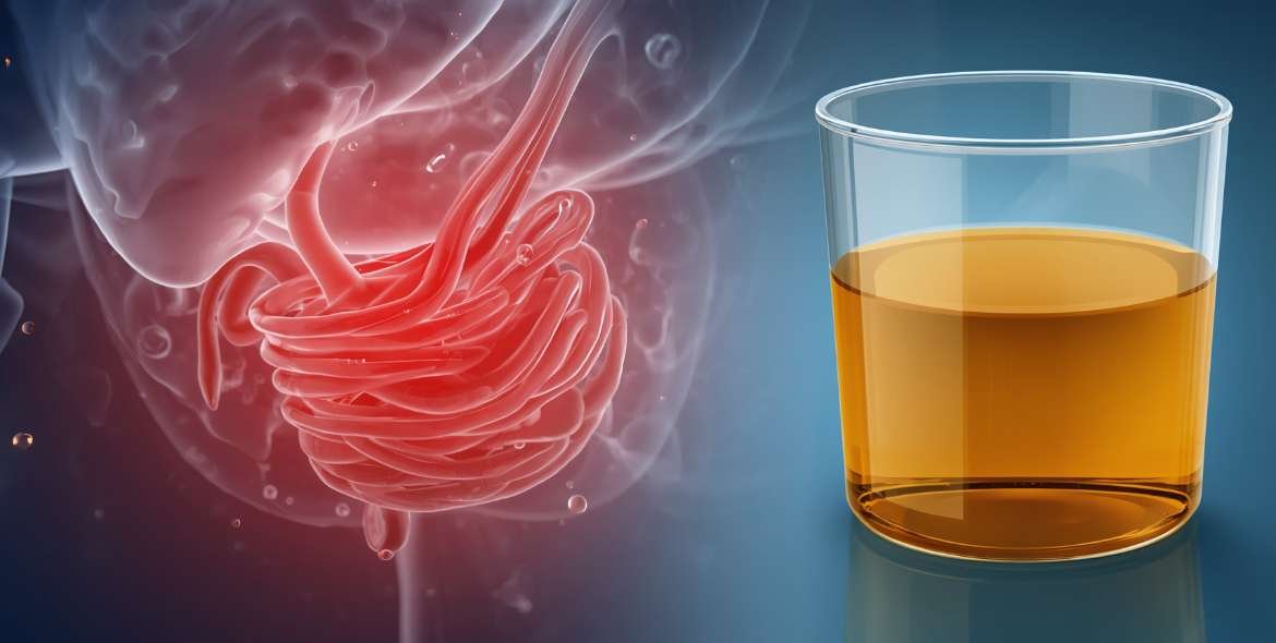 Dark Urine and Infrequent Urination